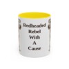 11oz Funny Irish Terrier Mug, Yellow, front view